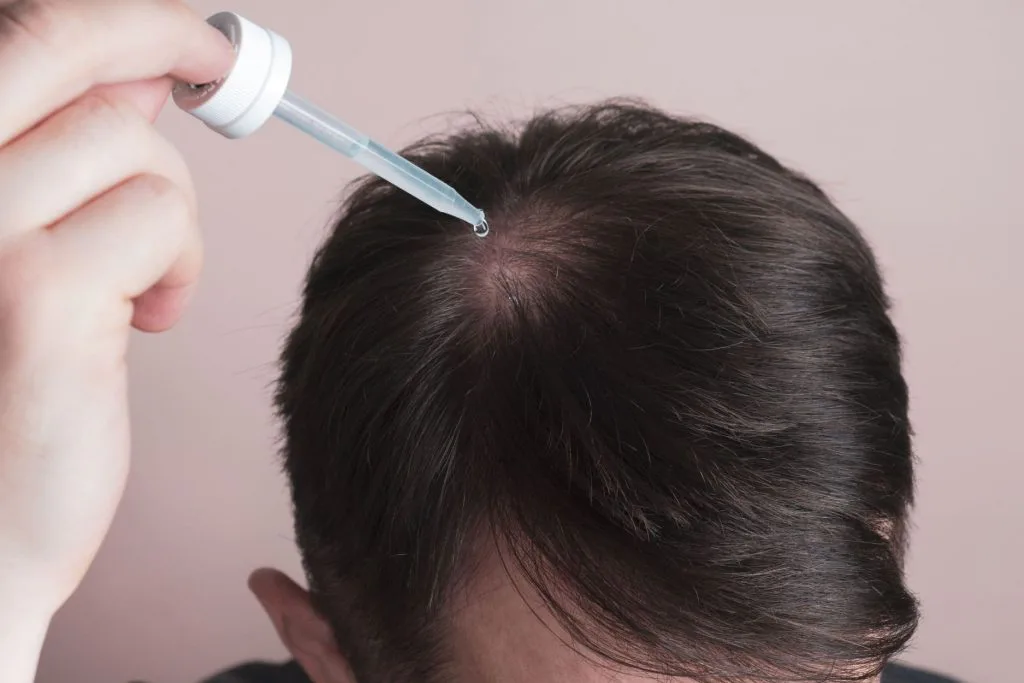 Minoxidil แบบทา