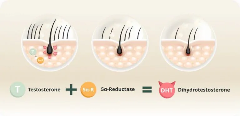 What causes DHT?