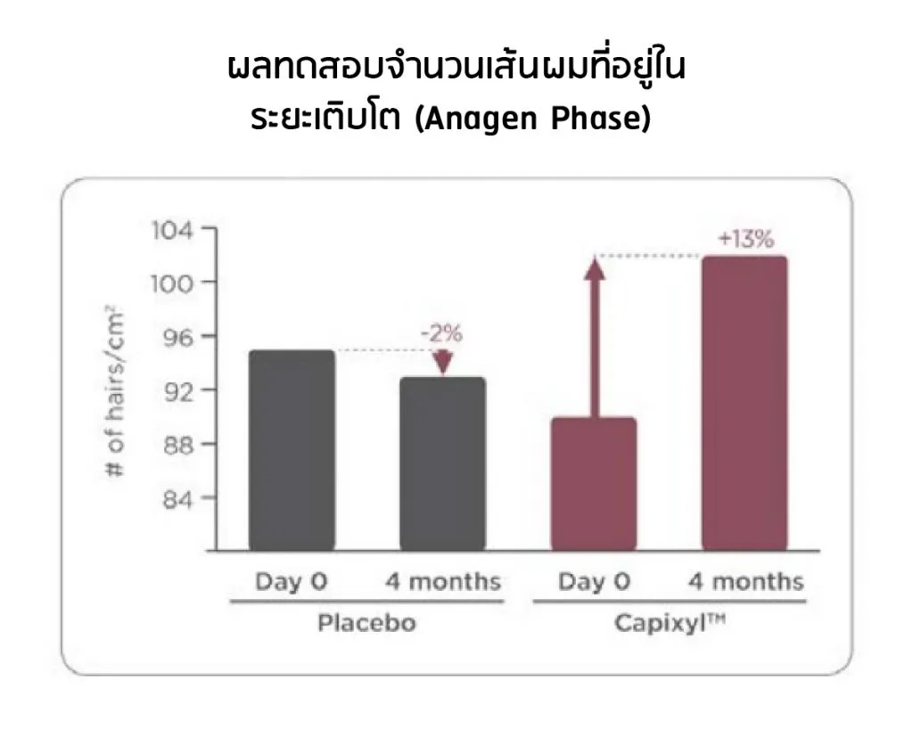 Clinical result — Capixyl in Anagen phase
