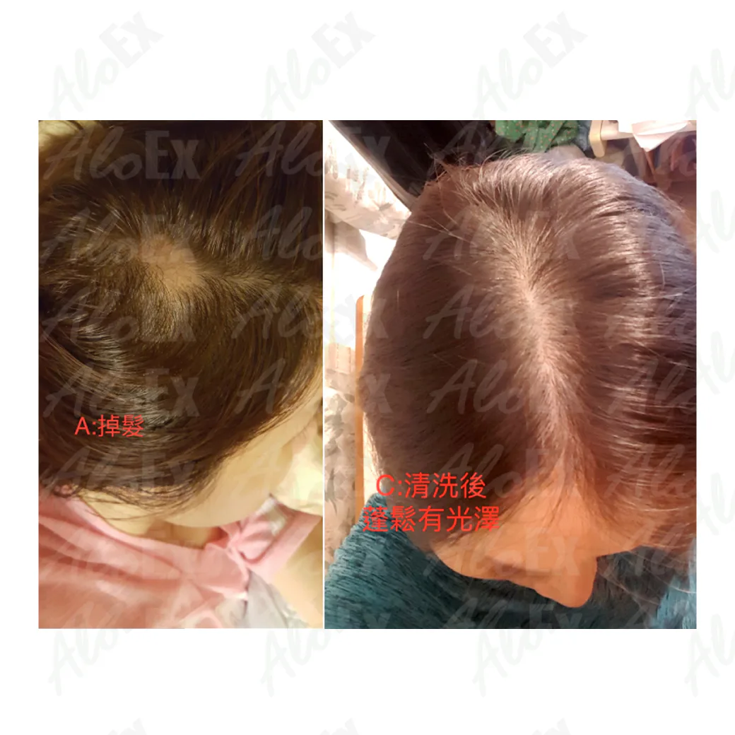 รีวิวก่อนใช้-หลังใช้ ผลิตภัณฑ์ AloEx