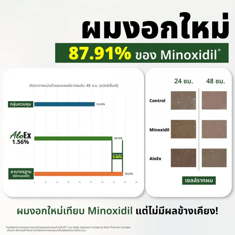 AloEx vs. Minoxidil