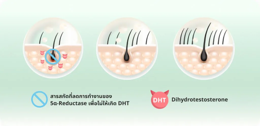 How to inhibit DHT