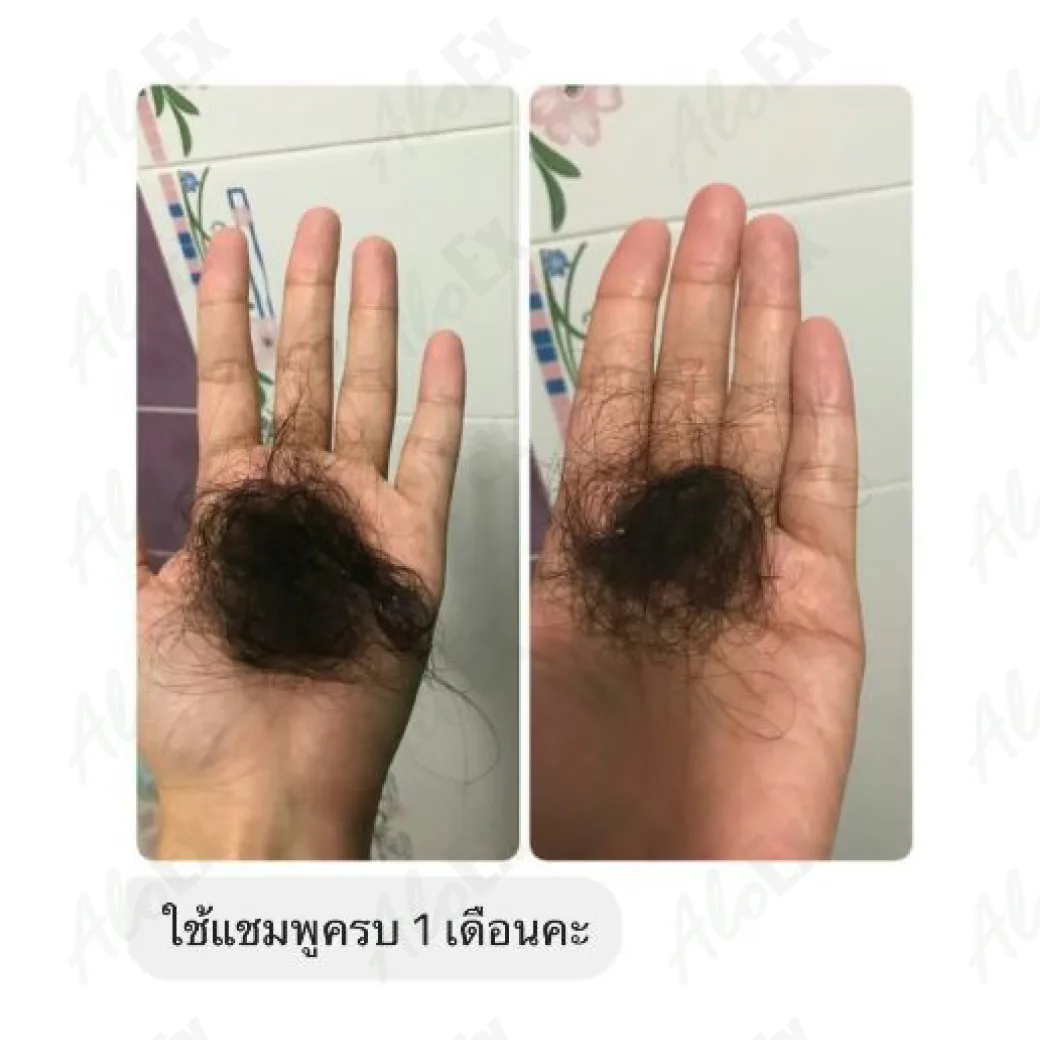 รีวิวก่อนใช้-หลังใช้ แชมพู AloEx