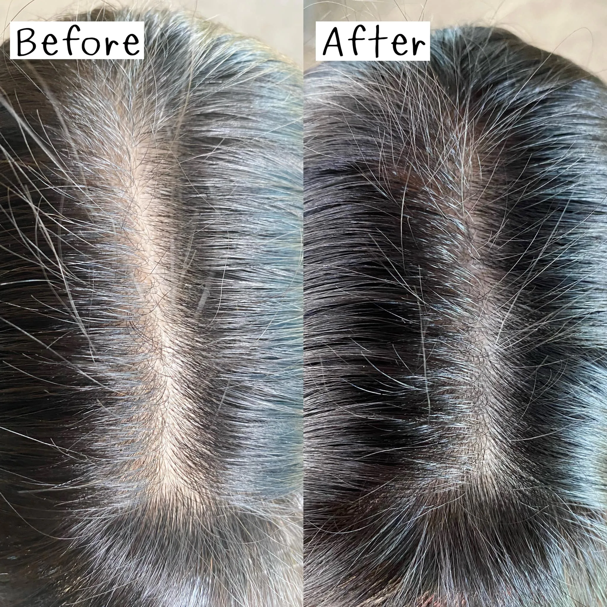 ไม่แน่ใจว่าผมที่พื้นกับบนหัวตรงไหนเยอะกว่ากัน? จึงอยากมาบอกต่อเซรั่มและ Hair Mask ของ AloExไม่แน่ใจว่าผมที่พื้นกับบนหัวตรงไหนเยอะกว่ากัน?